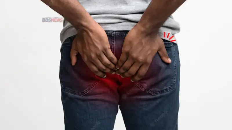 Berikut Cara Pengobatan Penyakit Ambien Atau Wasir Paling Ampuh Banget